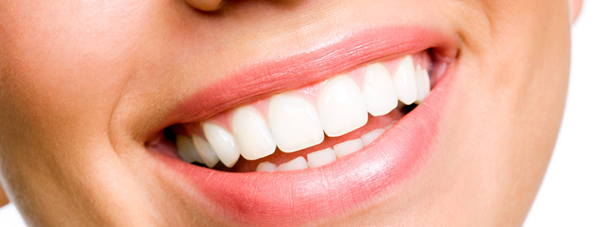 Teeth Whitening Las Vegas