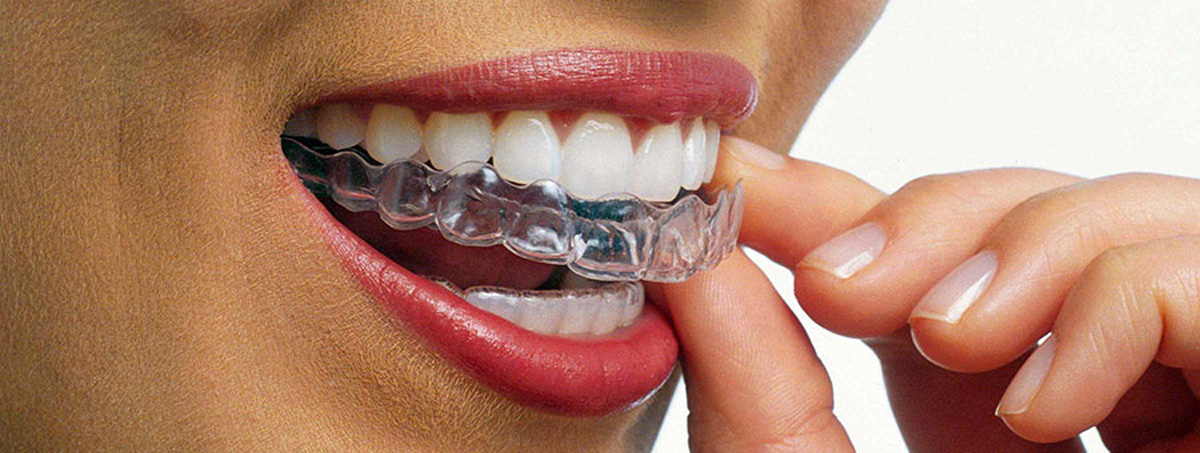 Invisalign Orthodontics Las Vegas